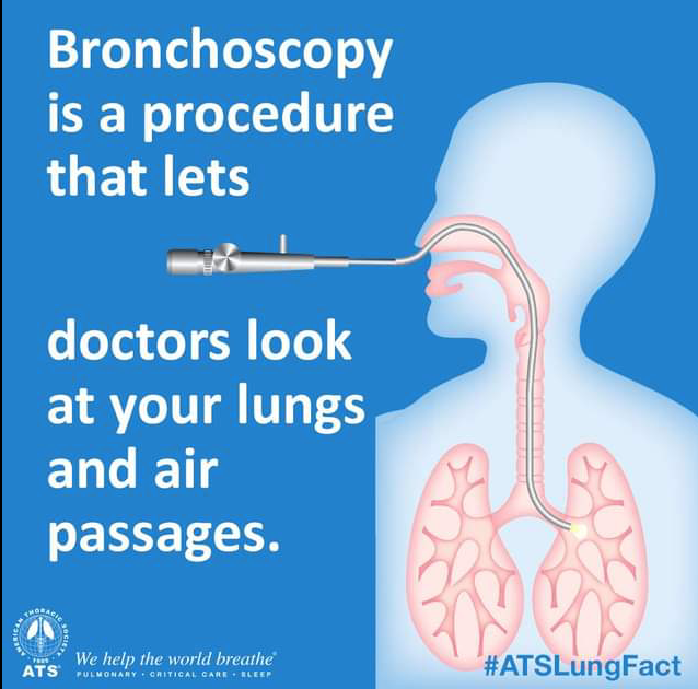 COPD treatment in Nagpur by Dr. Sameer Arbat