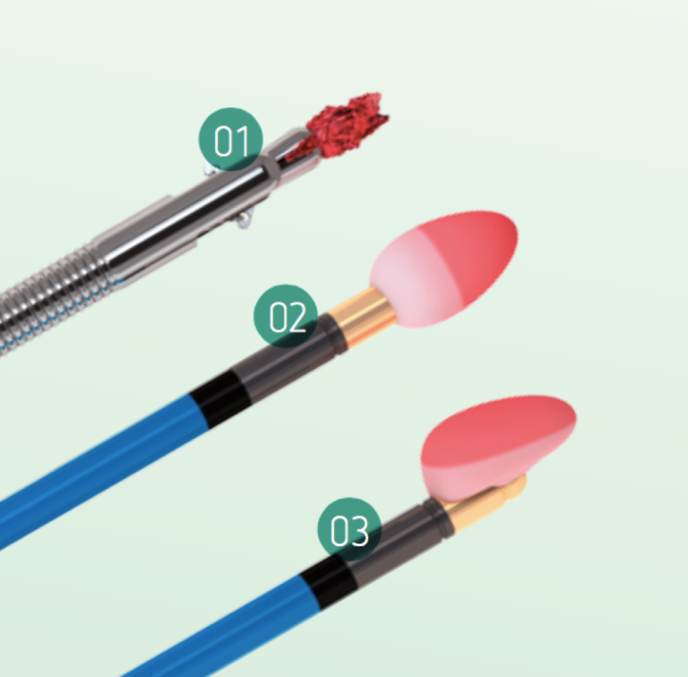 Cryosurgery and cryobiopsy at One Healthcare Nagpur